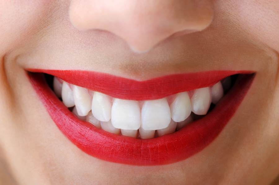 Wybielanie zębów – o czym warto wiedzieć?